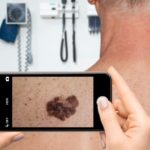 ai skin condition