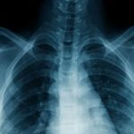 ai medical